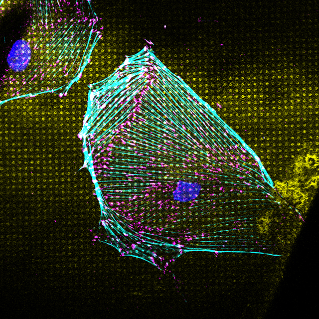 Cell imaged by cryo-electron tomography